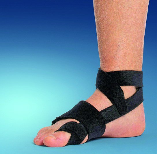 NRX-Tape bei Hallux valgus am Fuß